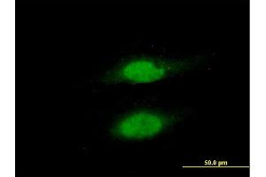 Immunofluorescence of purified MaxPab antibody to RAD23B on HeLa cell. (RAD23B anticorps  (AA 1-409))