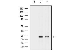 anti-CDC28 Protein Kinase Regulatory Subunit 1B (CKS1B) (N-Term) antibody