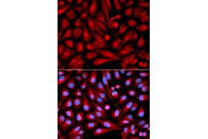 Immunofluorescence analysis of U2OS cells using MAP2K7 antibody (ABIN5971212). (MAP2K7 anticorps)