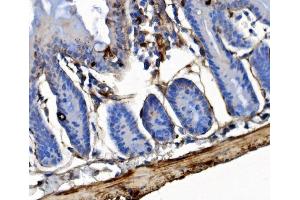 IHC analysis of Integrin Linked ILK using anti-Integrin Linked ILK antibody (ABIN7599411). (ILK anticorps  (AA 1-452))