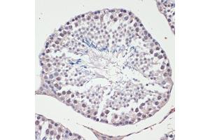 Immunohistochemistry of paraffin-embedded mouse testis using c-Jun antibody (ABIN6131074, ABIN6142670, ABIN6142671 and ABIN6215187) at dilution of 1:100 (40x lens).