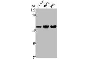 Western Blot analysis of Jurkat K562 NIH-3T3 cells using ENT1 Polyclonal Antibody (SLC29A1 anticorps  (N-Term))