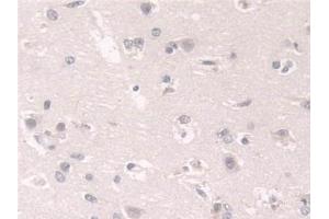 Detection of FKBP4 in Human Cerebrum Tissue using Polyclonal Antibody to FK506 Binding Protein 4 (FKBP4)