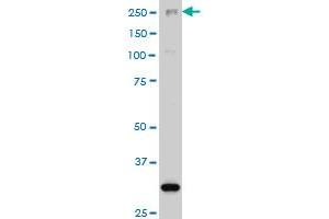 ARID1B monoclonal antibody (M02), clone 2F2 Western Blot analysis of ARID1B expression in Hela S3 NE . (ARID1B anticorps  (AA 1364-1460))