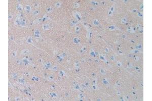 Figure. (SIRPA anticorps  (AA 105-324))