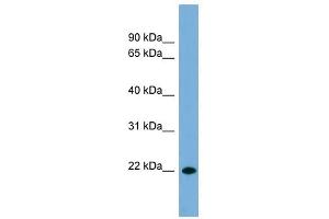 CD8B antibody used at 1 ug/ml to detect target protein. (CD8B anticorps  (Middle Region))