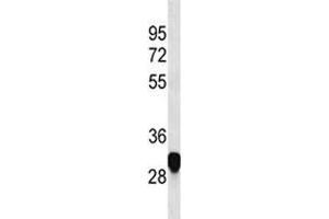 PLP antibody western blot analysis in HeLa lysate (PLP1 anticorps  (AA 248-277))
