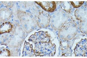 Immunohistochemistry of paraffin-embedded Rat kidney using PDE3A Polyclonal Antibody at dilution of 1:100 (40x lens). (PDE3A anticorps)