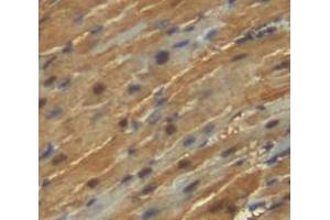 IHC-P analysis of heart tissue, with DAB staining. (KEAP1 anticorps  (AA 1-286))
