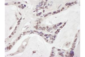 anti-AT Rich Interactive Domain 1B (SWI1-Like) (ARID1B) (AA 1850-1900) antibody