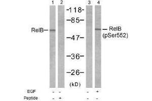 Image no. 1 for anti-V-Rel Reticuloendotheliosis Viral Oncogene Homolog B (RELB) (Ser552) antibody (ABIN197500) (RELB anticorps  (Ser552))