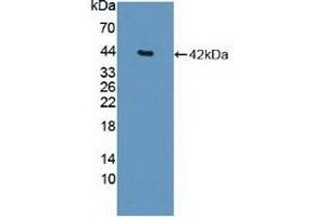 Detection of Recombinant HDAC9, Human using Polyclonal Antibody to Histone Deacetylase 9 (HDAC9) (HDAC9 anticorps  (AA 23-343))