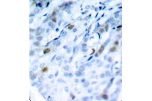Immunohistochemistry (IHC) image for anti-Cyclin-Dependent Kinase 1 (CDK1) (pThr161) antibody (ABIN3020136)