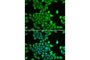 Immunofluorescence analysis of MCF-7 cells using PSMA6 antibody. (PSMA6 anticorps)