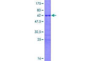 Image no. 1 for Homeobox D8 (HOXD8) (AA 1-289) protein (GST tag) (ABIN1307014)