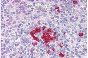 Human Spleen: Formalin-Fixed, Paraffin-Embedded (FFPE)