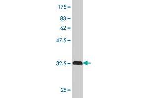 Western Blot detection against Immunogen (32. (MARCKS anticorps  (AA 2-65))