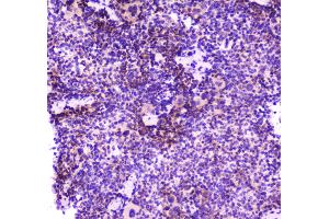 IHC analysis of PLCG 2 using anti-PLCG 2 antibody .