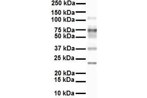 WB Suggested Anti-SLC27A3 antibody Titration: 1 ug/mL Sample Type: Human MCF7 (SLC27A3 anticorps  (Middle Region))