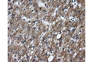 Immunohistochemical staining of paraffin-embedded liver tissue using anti-GBE1mouse monoclonal antibody. (GBE1 anticorps)