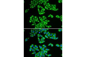 Immunofluorescence analysis of HeLa cells using DDX3X antibody.