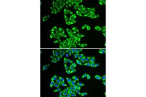 Immunofluorescence analysis of HeLa cells using DDX3X antibody. (DDX3X anticorps  (AA 1-220))