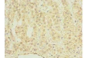 Immunohistochemistry of paraffin-embedded human adrenal gland tissue using ABIN7147636 at dilution of 1:100 (CHAD anticorps  (AA 23-359))