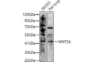 Western blot analysis of extracts of various cell lines, using (ABIN6134458, ABIN6150248, ABIN6150249 and ABIN6216485) at 1:1000 dilution. (WNT5A anticorps  (AA 250-350))