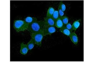 IF analysis of HSPH1 using anti-HSPH1 antibody (ABIN7602237). (HSPH1 anticorps  (AA 653-858))
