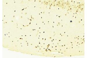 ABIN6276281 at 1/100 staining Mouse brain tissue by IHC-P.