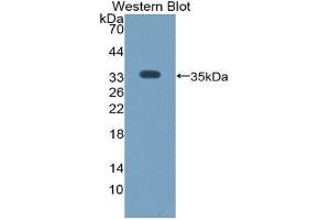 Western Blotting (WB) image for anti-Angiopoietin-Like 4 (ANGPTL4) (AA 183-401) antibody (Biotin) (ABIN1174067) (ANGPTL4 anticorps  (AA 183-401) (Biotin))