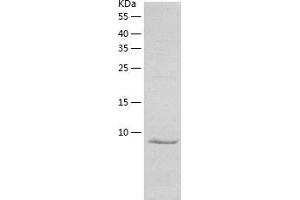 Western Blotting (WB) image for Chemokine (C-X3-C Motif) Ligand 1 (CX3CL1) (AA 25-100) protein (His-IF2DI Tag) (ABIN7122346)