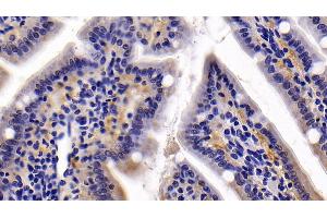 Detection of TFF2 in Rat Small intestine Tissue using Polyclonal Antibody to Trefoil Factor 2 (TFF2)