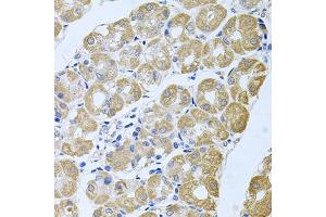 Immunohistochemistry of paraffin-embedded human stomach using STRN3 antibody (ABIN6129134, ABIN6148646, ABIN6148648 and ABIN6222490) at dilution of 1:100 (40x lens).