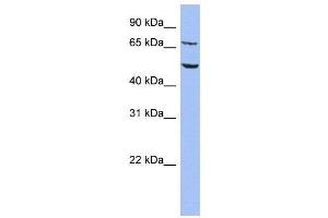 WB Suggested Anti-REPIN1  Antibody Titration: 0. (REPIN1 anticorps  (Middle Region))