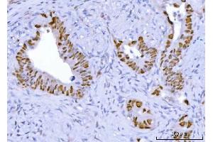 IHC analysis of TP53 using anti-TP53 antibody (ABIN7599050).