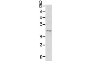 Gel: 8 % SDS-PAGE, Lysate: 60 μg, Lane: Raji cells, Primary antibody: ABIN7130829(RASSF7 Antibody) at dilution 1/800, Secondary antibody: Goat anti rabbit IgG at 1/8000 dilution, Exposure time: 5 seconds
