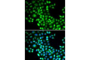 Immunofluorescence analysis of U2OS cells using FOXP1 antibody (ABIN5973033).