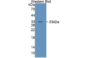Detection of Recombinant TESK1, Human using Polyclonal Antibody to Testis Specific Kinase 1 (TESK1) (TSSK1 anticorps  (AA 57-314))