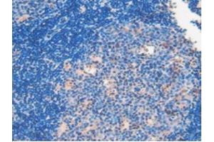 IHC-P analysis of Mouse Lymph Node Tissue, with DAB staining. (Involucrin anticorps  (AA 301-460))