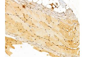 ABIN7094233 and ABIN7098280 at 1/100 staining Rat skin tissue by IHC-P. (FHL2 anticorps  (Internal Region))