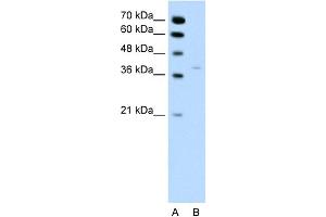 WB Suggested Anti-HSD17B1 Antibody Titration:  0. (HSD17B1 anticorps  (N-Term))