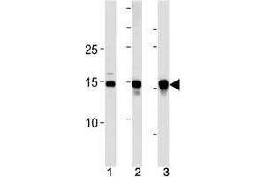 SUMO2/3 antibody western blot analysis in (10 U251 cells, (2)  mouse liver and (3) rat liver lysate. (SUMO2/3 anticorps  (AA 49-81))