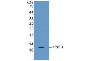 Detection of Recombinant MHCG, Human using Polyclonal Antibody to Major Histocompatibility Complex Class I G (MHCG)