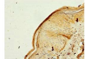 Immunohistochemistry of paraffin-embedded human skin tissue using ABIN7142443 at dilution of 1:100
