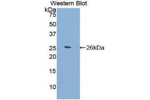 Western Blotting (WB) image for anti-Filamin C, gamma (FLNC) (AA 2519-2725) antibody (ABIN1858904)