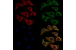 ABIN6257731 and ABIN6276215 staining Hela cells by IF/ICC.