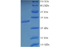 SDS-PAGE (SDS) image for Asparaginase Homolog (ASPG) (AA 206-346) protein (His-SUMO Tag) (ABIN4977141) (Asparaginase Protein (AA 206-346) (His-SUMO Tag))