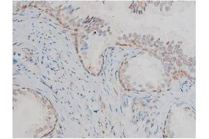 ABIN6267410 at 1/200 staining Human prostate tissue sections by IHC-P.