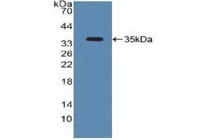 Detection of Recombinant ATF4, Human using Polyclonal Antibody to Activating Transcription Factor 4 (ATF4) (ATF4 anticorps  (AA 130-347))